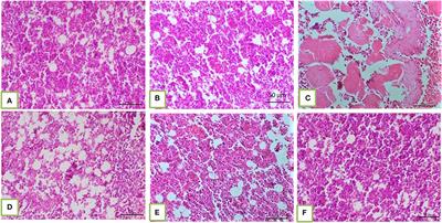 Ameliorative Effects of Bovine Lactoferrin on Benzene-Induced Hematotoxicity in Albino Rats